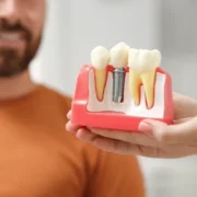 Türkiye’de Dental İmplant Tedavisi