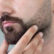 Trapianto di Barba