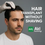 Hair Transplant Without Shaving