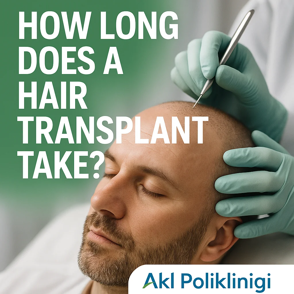 How Long Does a Hair Transplant Take?