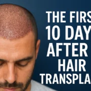 The First 10 Days After a Hair Transplant