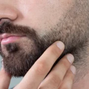 Greffe de barbe et de sourcils