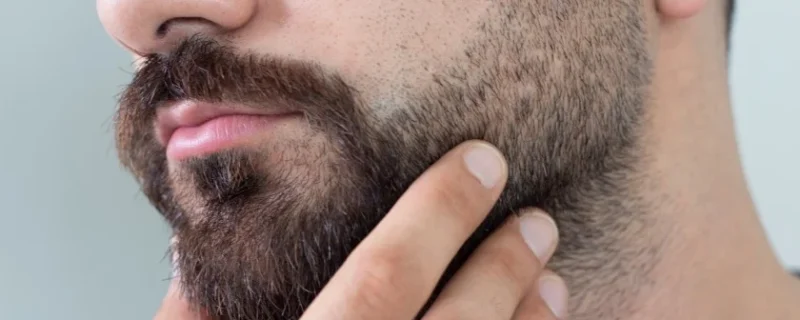 Beard and Eyebrow Transplantation
